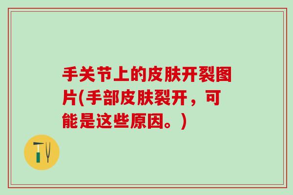 手关节上的皮肤开裂图片(手部皮肤裂开，可能是这些原因。)