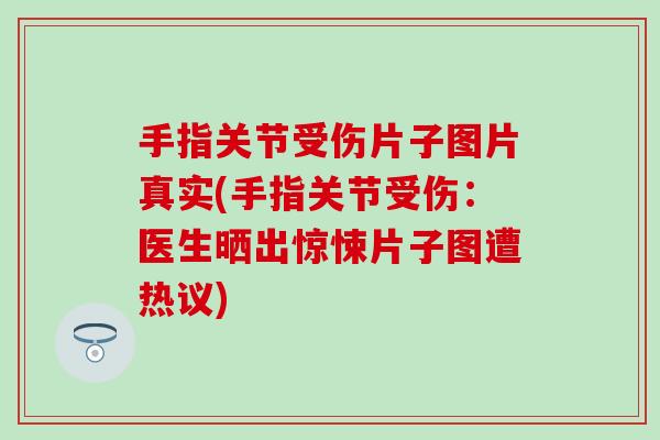 手指关节受伤片子图片真实(手指关节受伤：医生晒出惊悚片子图遭热议)