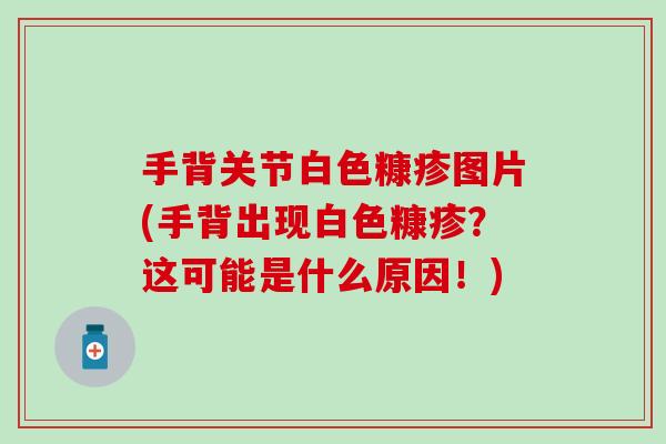 手背关节白色糠疹图片(手背出现白色糠疹？这可能是什么原因！)