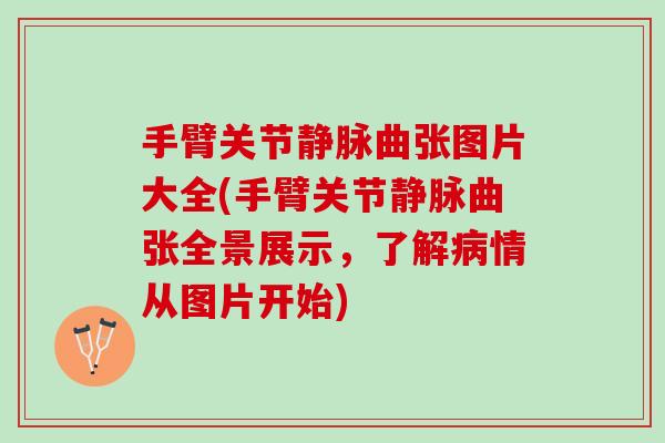 手臂关节静脉曲张图片大全(手臂关节静脉曲张全景展示，了解病情从图片开始)