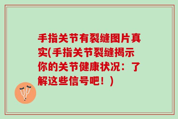 手指关节有裂缝图片真实(手指关节裂缝揭示你的关节健康状况:了解这些信号吧!) 手指关节有裂缝图片真实(手指关节裂缝揭示你的关节健康状况:了解这些信号吧!)