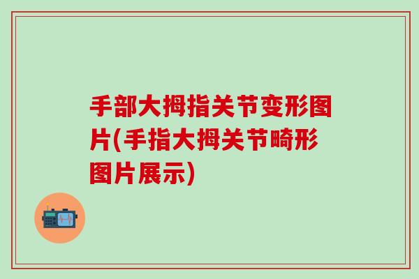 手部大拇指关节变形图片(手指大拇关节畸形图片展示)