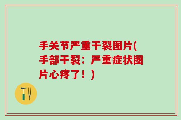 手关节严重干裂图片(手部干裂：严重症状图片心疼了！)