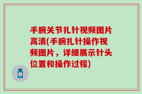 手腕关节扎针视频图片高清(手腕扎针操作视频图片，详细展示针头位置和操作过程)
