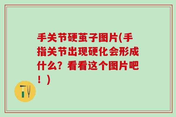 手关节硬茧子图片(手指关节出现硬化会形成什么？看看这个图片吧！)