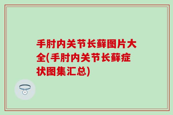 手肘内关节长藓图片大全(手肘内关节长藓症状图集汇总) 手肘内关节长藓图片大全(手肘内关节长藓症状图集汇总)