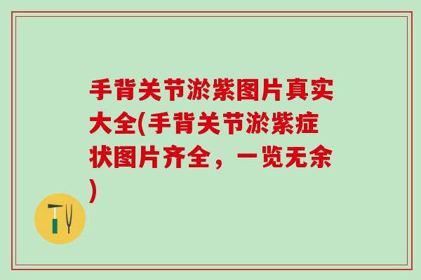 手背关节淤紫图片真实大全(手背关节淤紫症状图片齐全，一览无余)