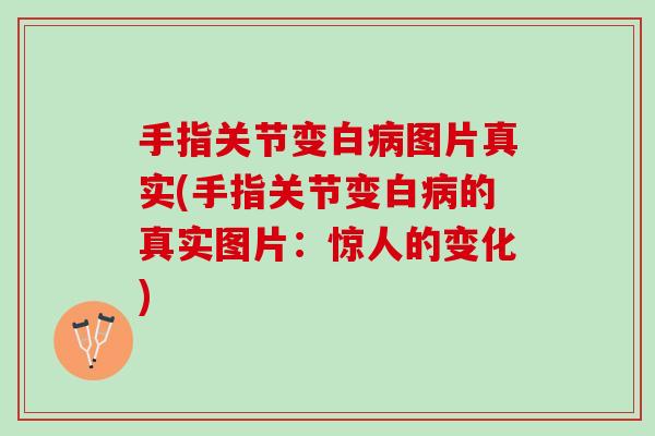 手指关节变白病图片真实(手指关节变白病的真实图片：惊人的变化)