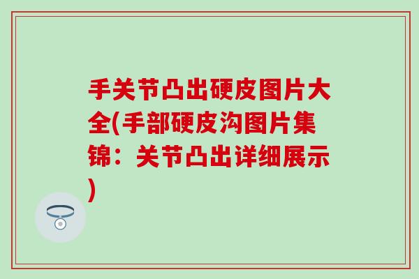 手关节凸出硬皮图片大全(手部硬皮沟图片集锦：关节凸出详细展示)