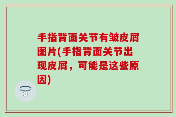 手指背面关节有皱皮屑图片(手指背面关节出现皮屑，可能是这些原因)