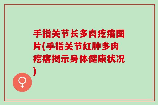 手指关节长多肉疙瘩图片(手指关节红肿多肉疙瘩揭示身体健康状况)