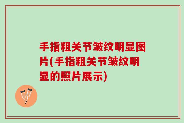 手指粗关节皱纹明显图片(手指粗关节皱纹明显的照片展示) 手指粗关节皱纹明显图片(手指粗关节皱纹明显的照片展示)