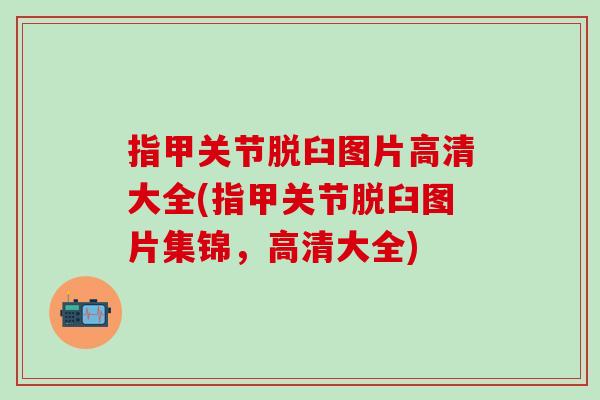 指甲关节脱臼图片高清大全(指甲关节脱臼图片集锦,高清大全) 指甲关节脱臼图片高清大全(指甲关节脱臼图片集锦,高清大全)