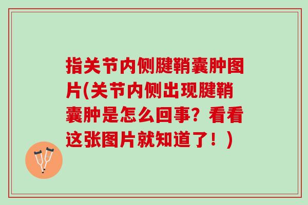 指关节内侧腱鞘囊肿图片(关节内侧出现腱鞘囊肿是怎么回事？看看这张图片就知道了！)