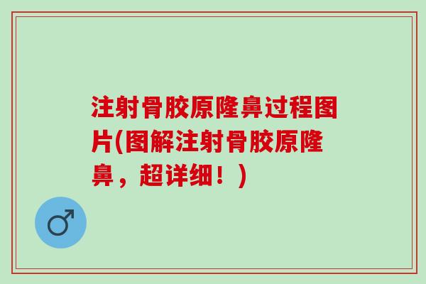 注射骨胶原隆鼻过程图片(图解注射骨胶原隆鼻，超详细！)