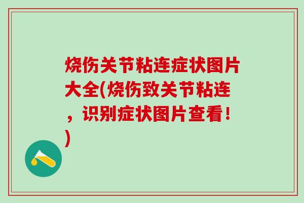 烧伤关节粘连症状图片大全(烧伤致关节粘连，识别症状图片查看！)