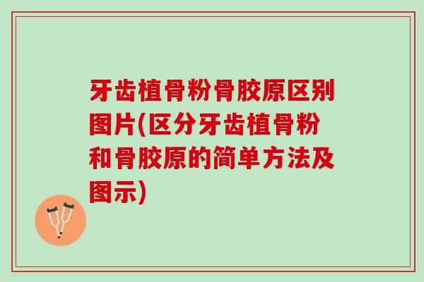 牙齿植骨粉骨胶原区别图片(区分牙齿植骨粉和骨胶原的简单方法及图示)