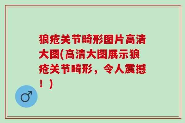 狼疮关节畸形图片高清大图(高清大图展示狼疮关节畸形，令人震撼！)