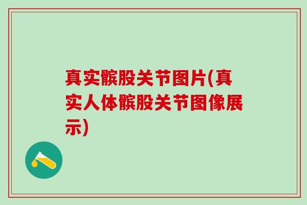真实髌股关节图片(真实人体髌股关节图像展示) 真实髌股关节图片(真实人体髌股关节图像展示)