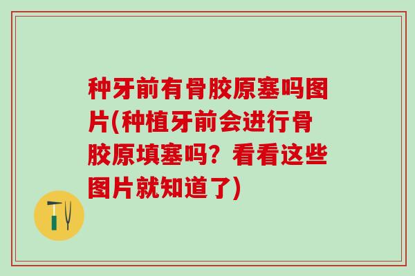 种牙前有骨胶原塞吗图片(种植牙前会进行骨胶原填塞吗？看看这些图片就知道了)