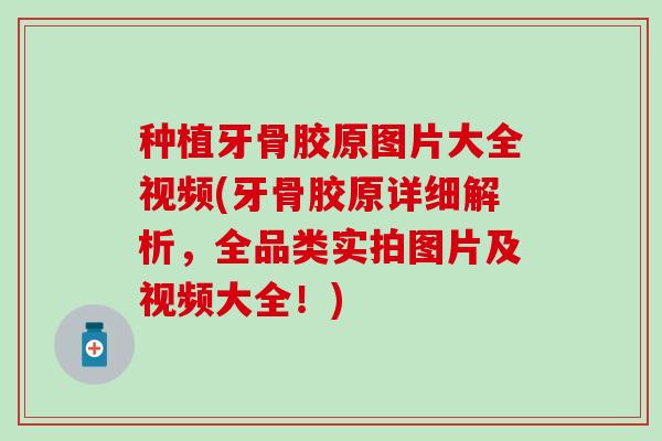 种植牙骨胶原图片大全视频(牙骨胶原详细解析，全品类实拍图片及视频大全！)