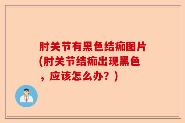 肘关节有黑色结痂图片(肘关节结痂出现黑色，应该怎么办？)