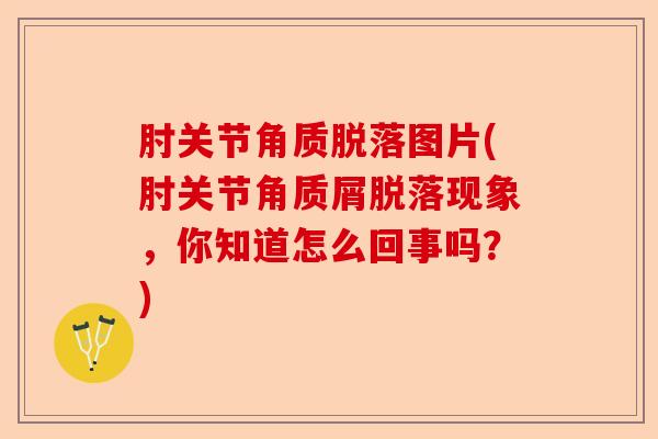 肘关节角质脱落图片(肘关节角质屑脱落现象，你知道怎么回事吗？)