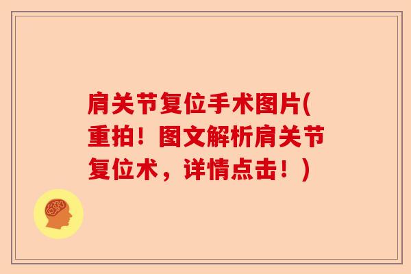 肩关节复位手术图片(重拍！图文解析肩关节复位术，详情点击！)