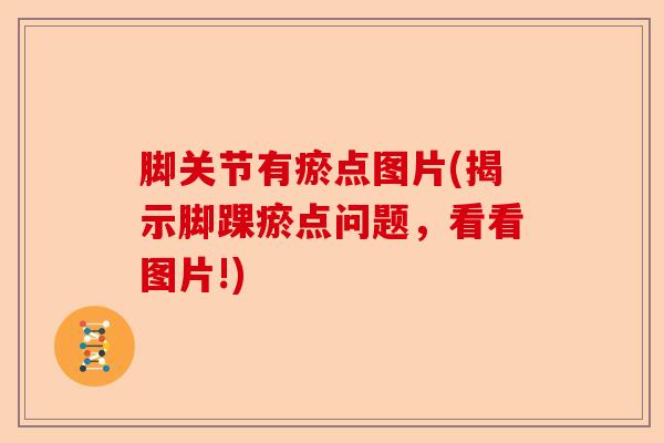 脚关节有瘀点图片(揭示脚踝瘀点问题,看看图片!) 脚关节有瘀点图片(揭示脚踝瘀点问题,看看图片!)