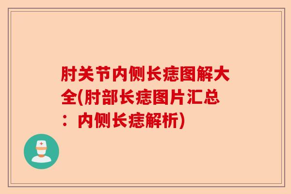 肘关节内侧长痣图解大全(肘部长痣图片汇总:内侧长痣解析) 肘关节内侧长痣图解大全(肘部长痣图片汇总:内侧长痣解析)