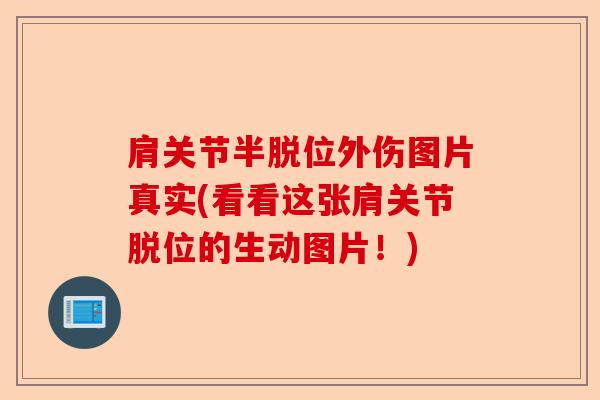 肩关节半脱位外伤图片真实(看看这张肩关节脱位的生动图片！)