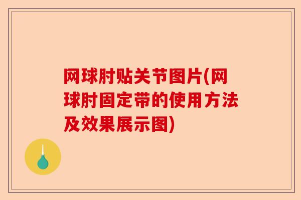 网球肘贴关节图片(网球肘固定带的使用方法及效果展示图)