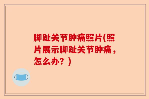 脚趾关节肿痛照片(照片展示脚趾关节肿痛，怎么办？)