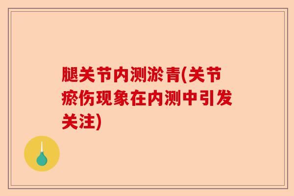 腿关节内测淤青(关节瘀伤现象在内测中引发关注)