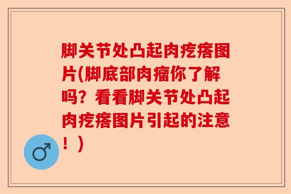 脚关节处凸起肉疙瘩图片(脚底部肉瘤你了解吗？看看脚关节处凸起肉疙瘩图片引起的注意！)
