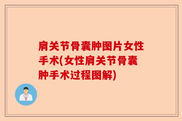 肩关节骨囊肿图片女性手术(女性肩关节骨囊肿手术过程图解)