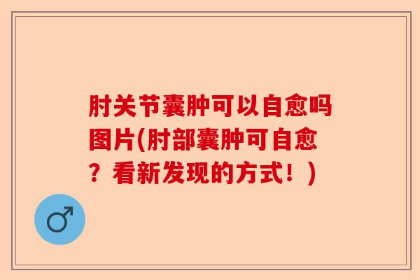 肘关节囊肿可以自愈吗图片(肘部囊肿可自愈？看新发现的方式！)