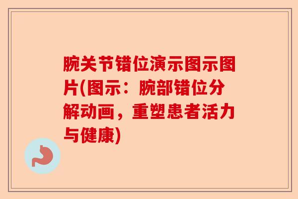 腕关节错位演示图示图片(图示：腕部错位分解动画，重塑患者活力与健康)