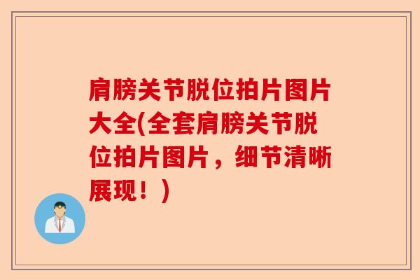肩膀关节脱位拍片图片大全(全套肩膀关节脱位拍片图片，细节清晰展现！)