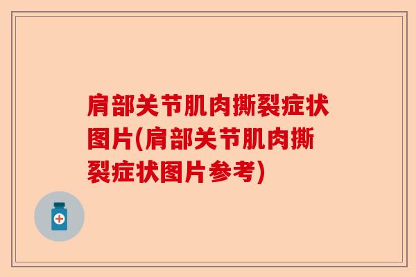 肩部关节肌肉撕裂症状图片(肩部关节肌肉撕裂症状图片参考)