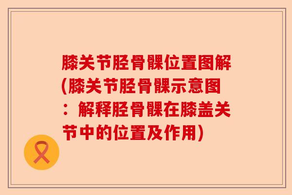膝关节胫骨髁位置图解(膝关节胫骨髁示意图：解释胫骨髁在膝盖关节中的位置及作用)