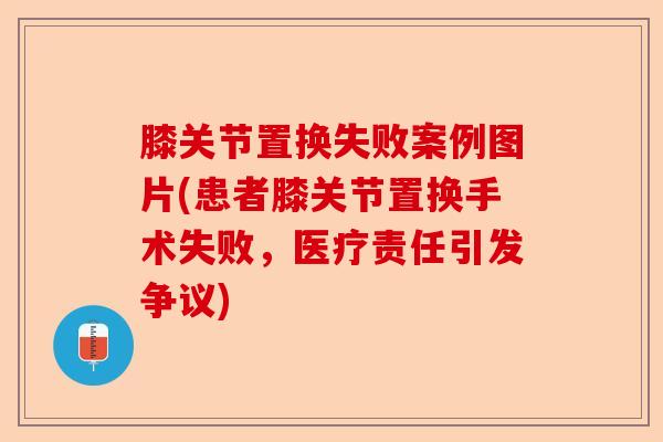 膝关节置换失败案例图片(患者膝关节置换手术失败，医疗责任引发争议)