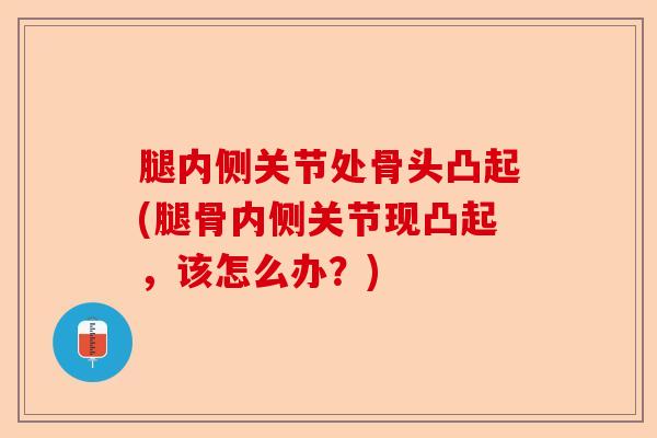 腿内侧关节处骨头凸起(腿骨内侧关节现凸起,该怎么办?) 腿内侧关节处骨头凸起(腿骨内侧关节现凸起,该怎么办?)