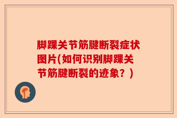 脚踝关节筋腱断裂症状图片(如何识别脚踝关节筋腱断裂的迹象？)