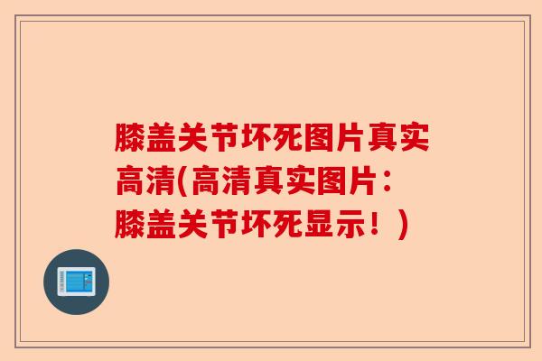 膝盖关节坏死图片真实高清(高清真实图片：膝盖关节坏死显示！)
