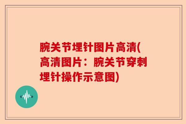 腕关节埋针图片高清(高清图片：腕关节穿刺埋针操作示意图)