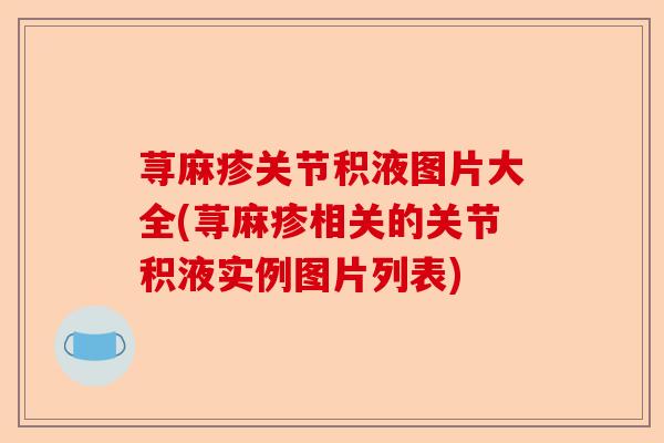 荨麻疹关节积液图片大全(荨麻疹相关的关节积液实例图片列表)