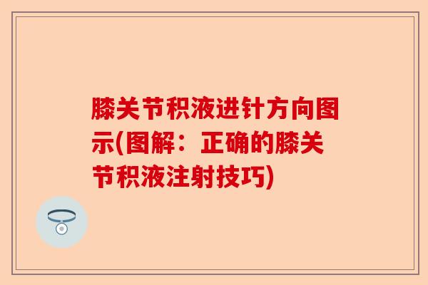 膝关节积液进针方向图示(图解：正确的膝关节积液注射技巧)