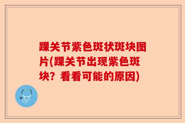 踝关节紫色斑状斑块图片(踝关节出现紫色斑块?看看可能的原因) 踝关节紫色斑状斑块图片(踝关节出现紫色斑块?看看可能的原因)