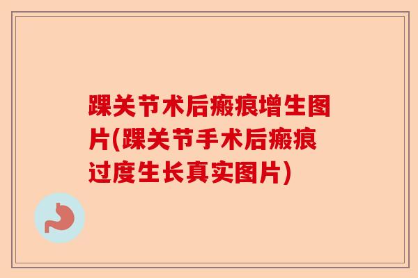 踝关节术后瘢痕增生图片(踝关节手术后瘢痕过度生长真实图片)